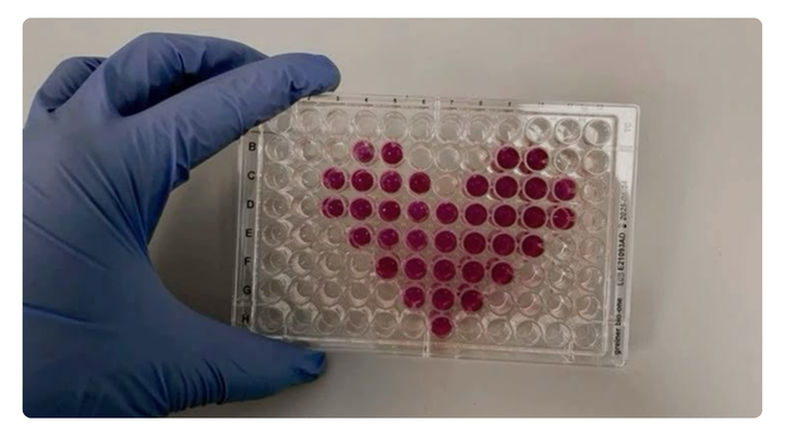 Anaemia affects women worldwide, but India bears the highest burden. Learn how diet, absorption, and better iron supplementation can change outcomes.