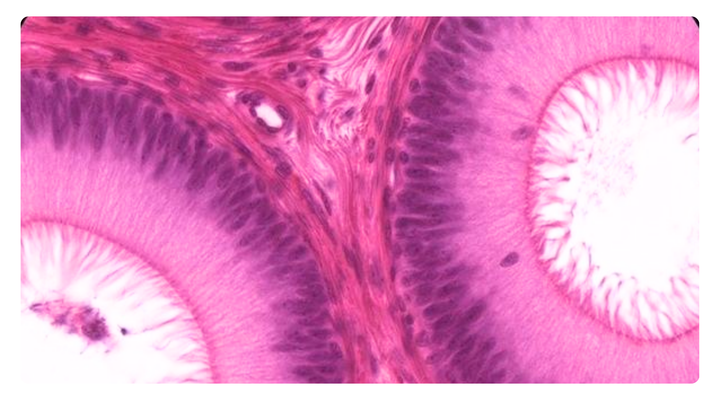 Roz’s liposomal iron delivers smarter absorption with zero side effects-  gentle, science-backed iron made for Indian women’s real needs.